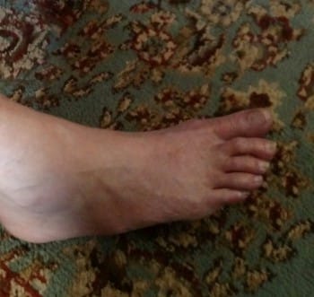 Pretty feet!